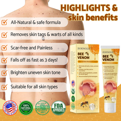 🐝🐝[✨𝐎𝐟𝐟𝐢𝐜𝐢𝐚𝐥 𝐁𝐫𝐚𝐧𝐝 𝐒𝐭𝐨𝐫𝐞✨] 𝐙𝐨𝐞𝐧𝐜𝐠𝐳™ 𝐁𝐞𝐞 𝐕𝐞𝐧𝐨𝐦 𝐌𝐨𝐥𝐞 𝐚𝐧𝐝 𝐖𝐚𝐫𝐭 𝐓𝐫𝐞𝐚𝐭𝐦𝐞𝐧𝐭 𝐂𝐫𝐞𝐚𝐦(👨‍⚕𝐀𝐀𝐃 𝐑𝐄𝐂𝐎𝐌𝐌𝐄𝐍𝐃𝐒)